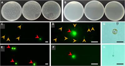 Screening of antibiotics to obtain axenic cell cultures of a marine microalga Chrysotila roscoffensis